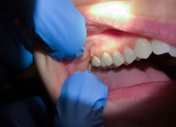 Best Pediatric Emergency Dentist in Cove Creek, NC
